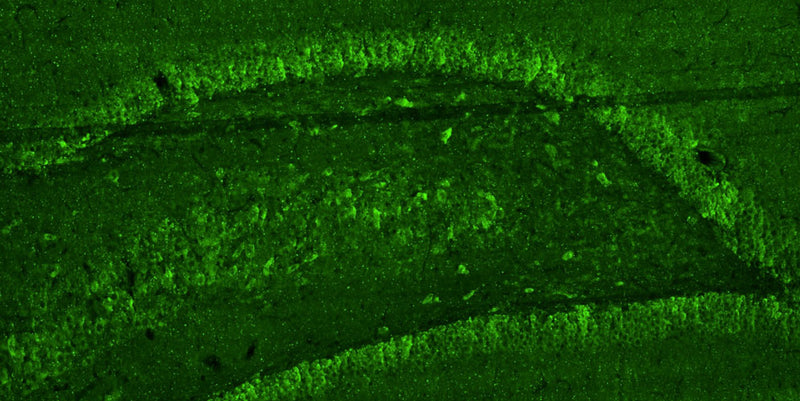 Representative section of formalin fixed, paraffin-embedded rat brain hippocampal region showing cells stained by anti-GluA2/GluR2 Glutamate Receptor recombinant chicken mAb (green, Cat No. 78-002) using goat anti-chicken IgY CF®488 secondary antibody (Cat No. 80-1001-488).