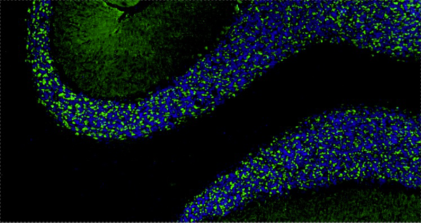 78-028-ihc-