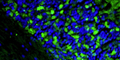 Formalin fixed, paraffin-embedded rat brain cerebellum region showing staining of PSD-95. The sections were stained with anti-PSD-95 recombinant chicken monoclonal antibody (green)  (Cat. 78-028) at 1:500 dilution. The stained sections were mounted with Antibodies Incorporated FluoroshieldTM with DAPI and DABCO mounting medium (Cat. AR-6505). DAPI nuclear stain (blue) shows cell nuclei. Anti-PSD-95 specifically stains the excitatory synapses in the granular layer of the cerebellum.​ Magnification 400X.