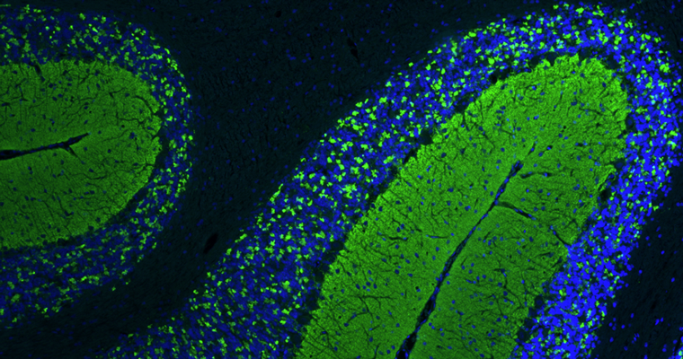 Formalin fixed, paraffin-embedded rat brain cerebellum region showing staining of VGlut1. The sections were stained with anti-VGlut1 recombinant chicken monoclonal antibody (green) (Cat No. 78-066) at 1:100 dilution. The stained sections were mounted with Antibodies Incorporated FluoroshieldTM with DAPI and DABCO mounting medium (Cat. No. AR-6505). DAPI nuclear stain (blue) shows cell nuclei. Anti-VGlut1 specifically stains the axonal synapses in the granular layer of the cerebellum.​ Magnification 100X.