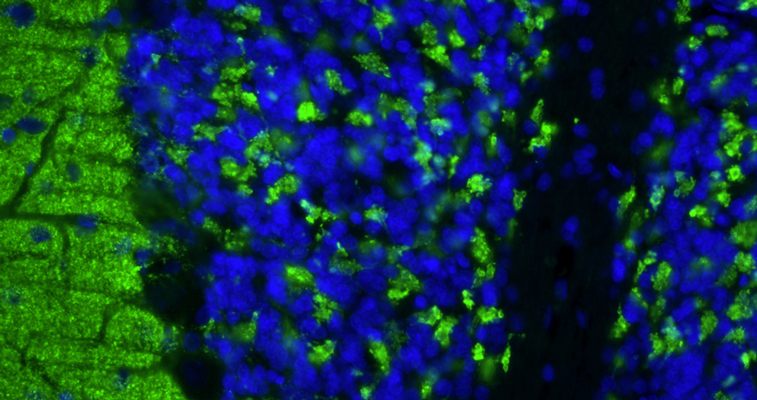 Formalin fixed, paraffin-embedded rat brain cerebellum region showing staining of VGlut1. The sections were stained with anti-VGlut1 recombinant chicken monoclonal antibody (green) (Cat No. 78-066) at 1:100 dilution. The stained sections were mounted with Antibodies Incorporated FluoroshieldTM with DAPI and DABCO mounting medium (Cat. No. AR-6505). DAPI nuclear stain (blue) shows cell nuclei. Anti-VGlut1 specifically stains the axonal synapses in the granular layer of the cerebellum.​ Magnification 400X.