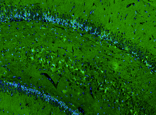 Representative section of formalin fixed, paraffin-embedded rat brain hippocampus showing neurons in CA4 region stained by anti-GluN2B recombinant chicken monoclonal antibody (Cat. 78-097) using goat anti-chicken IgY CF®488 secondary antibody (Cat. 80-1001-488) (visualized in green). The stained sections were mounted with Antibodies Incorporated Fluoroshield with DAPI and DABCO mounting medium (Cat. AR-6505). DAPI nuclear stain (blue) shows cell nuclei.