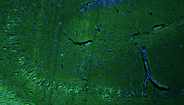 Representative section of formalin fixed, paraffin-embedded rat brain hippocampus region showing cells stained anti-RGS14 recombinant chicken monoclonal antibody (Cat. 78-170) using goat anti-chicken IgY CF®488 secondary antibody (Cat. 80-1001-488) (green). The stained sections were mounted with Fluoroshield with DAPI and DABCO mounting medium (Cat. AR-6505). DAPI nuclear stain (blue) shows cell nuclei. Anti-RGS14 specifically stains the pyramidal neurons in the CA2 region of the hippocampus.