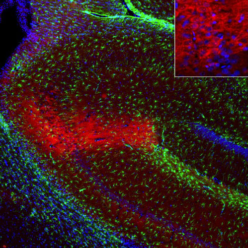 Representative image of 4% paraformaldehyde fixed free-floating rat brain sections stained with anti-RGS14 recombinant chicken monoclonal antibody (red) at 1:1000 dilution and co-stained with anti-GFAP rabbit polyclonal antibody (green). DAPI nuclear stain (blue) shows cell nuclei. Anti-RGS14 specifically stains the pyramidal neurons in the CA2 region of the hippocampus. Image courtesy of EnCor Biotechnology.