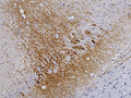Representative image of 4% paraformaldehyde fixed free-floating rat brain sections stained with anti-RGS14 recombinant chicken monoclonal antibody (brown) at 1:1000 dilution. Anti-RGS14 stains specific neurons and processes in the rat frontal cortex. Magnification 200X. Image courtesy of EnCor Biotechnology.
