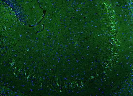 Formalin fixed, paraffin-embedded rat brain hippocampus showing oligodendocytes stained by Olig1 recombinant chicken monoclonal antibody  (Cat. 78-180) using goat anti-chicken IgY CF®488 secondary antibody (Cat. 80-1001-488) (visualized in green). Mounted with Antibodies Incorporated Fluoroshield with DAPI and DABCO mounting medium (Cat. AR-6505). DAPI nuclear stain (blue) shows cell nuclei. Anti-Olig1 specifically stains the oligodendrocytes present in the CA3 and CA4 regions of