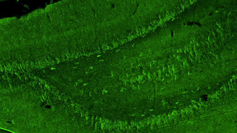 Representative section of formalin fixed, paraffin-embedded rat brain hippocampal region showing cells stained by anti-GluA1/GluR1 Glutamate Receptor recombinant chicken mAb (green, Cat No. 78-327) antibody using goat anti-chicken IgY CF®488 secondary antibody (Cat No. 80-1001-488).