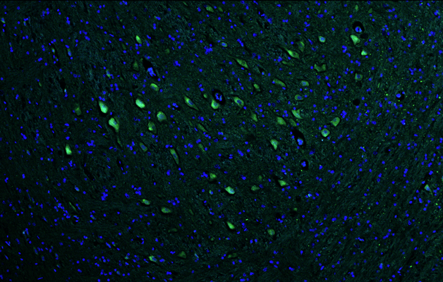Representative section of formalin fixed, paraffin-embedded rat brain stem showing facial motor neurons stained by VAChT (Slc18a3) recombinant chicken monoclonal antibody  (Cat. 78-180) using goat anti-chicken IgY CF®488 secondary antibody (Cat. 80-1001-488) (green). The stained sections were mounted with Antibodies Incorporated Fluoroshield with DAPI and DABCO mounting medium (Cat. AR-6505). DAPI nuclear stain (blue) shows cell nuclei. 