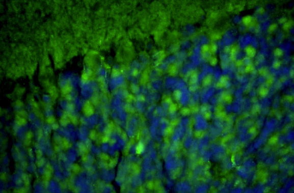 Representative section of formalin fixed, paraffin-embedded rat brain cerebellum region showing staining of Homer1 with anti-Homer1 recombinant chicken monoclonal antibody (green) (Cat No 78-454) at 1:100 dilution. The stained sections were mounted with FluoroshieldTM with DAPI and DABCO mounting medium (Cat No. AR-6505). DAPI nuclear stain (blue) shows cell nuclei. Anti-Homer1 stains the postsynaptic densities of the Purkinje cell dendrites in the molecular layer of the cerebellum.​ Magnification 400X.