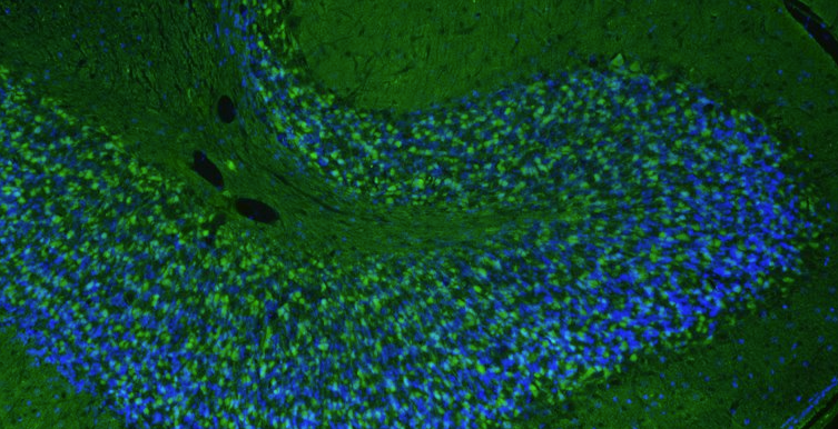 Representative FFPE section of rat brain cerebellum showing Homer1 staining. The sections were stained with anti-Homer1 recombinant chicken Mab (Cat No. 78-454) using goat anti-chicken IgY FITC secondary antibody (Cat No. F-1005) (green). The stained sections were mounted with Fluoroshield (DAPI & DABCO) mounting medium (Cat No. AR-6505). DAPI (blue) stains cell nuclei. Anti-Homer1 stains the postsynaptic densities of the Purkinje cell dendrites in the molecular layer of the cerebellum.​