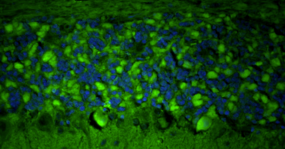 Representative FFPE section of rat brain cerebellum showing Homer1 staining. The sections were stained with anti-Homer1 recombinant chicken Mab (Cat No. 78-454) using goat anti-chicken IgY FITC secondary antibody (Cat No. F-1005) (green). The stained sections were mounted with Fluoroshield (DAPI & DABCO) mounting medium (Cat No. AR-6505). DAPI (blue) stains cell nuclei. Anti-Homer1 stains the postsynaptic densities of the Purkinje cell dendrites in the molecular layer of the cerebellum.​