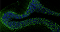 Representative FFPE section of rat brain cerebellum showing VGAT staining. The sections were stained with anti-VGAT recombinant chicken monoclonal antibody (Cat. 78-457) using goat anti-chicken IgY FITC secondary antibody (Cat. 80-1000-FITC) (green). The stained sections were mounted with Fluoroshield (DAPI and DABCO) mounting medium (Cat. AR-6505). DAPI (blue) stains cell nuclei. Anti-VGAT stains the GABAergic terminals and neurons in the cerebellum. Magnification 100X.​