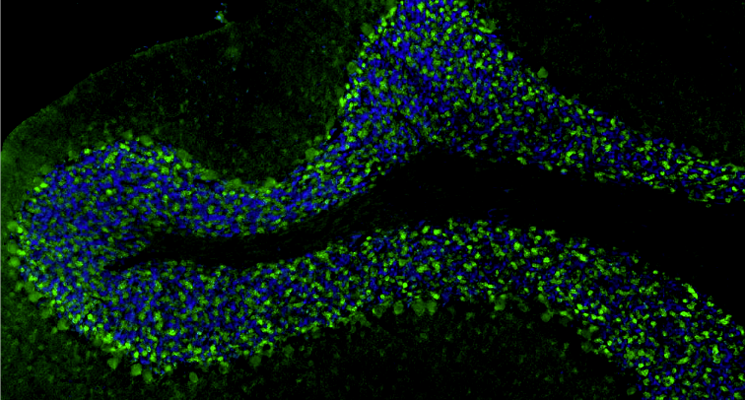 Representative FFPE section of rat brain cerebellum showing VGAT staining. The sections were stained with anti-VGAT recombinant chicken monoclonal antibody (Cat No. 78-457) using goat anti-chicken IgY FITC secondary antibody (Cat No. 80-1000-FITC) (green). The stained sections were mounted with Fluoroshield (DAPI and DABCO) mounting medium (Cat No. AR-6505). DAPI (blue) stains cell nuclei. Anti-VGAT stains the GABAergic terminals and neurons in the cerebellum. Magnification 100X.​