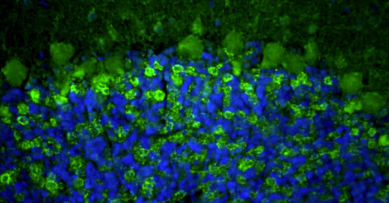 Representative FFPE section of rat brain cerebellum showing VGAT staining. The sections were stained with anti-VGAT recombinant chicken monoclonal antibody (Cat No. 78-457) using goat anti-chicken IgY FITC secondary antibody (Cat No. 80-1000-FITC) (green). The stained sections were mounted with Fluoroshield (DAPI and DABCO) mounting medium (Cat No. AR-6505). DAPI (blue) stains cell nuclei. Anti-VGAT stains the GABAergic terminals and neurons in the cerebellum. Magnification 400X.​