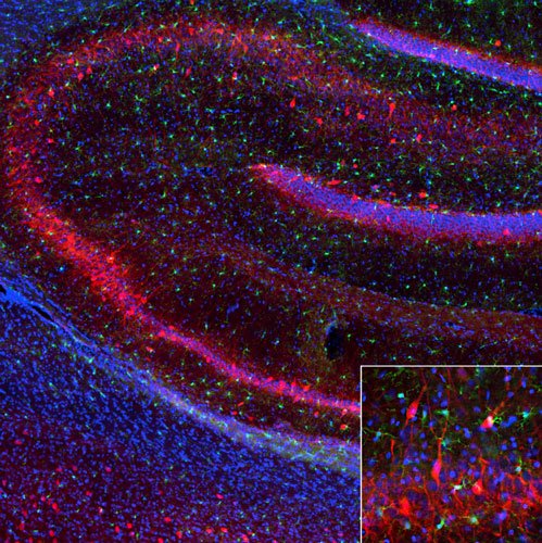 Representative image of 4% paraformaldehyde fixed free-floating rat hippocampus sections stained with Aves Labs anti-Parvalbumin recombinant chicken monoclonal antibody (red,  Cat No. 78-479) at 1:1000 dilution and co-stained with anti-Iba1 rabbit polyclonal antibody (green). DAPI nuclear stain (blue) shows cell nuclei. Anti-Parvalbumin specifically
