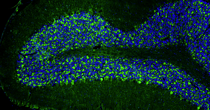 Representative section of formalin fixed, paraffin-embedded rat brain cerebellum region stained with anti-Bassoon recombinant chicken monoclonal antibody (green) (Cat No. 78-491) at 1:100 dilution. The sections were mounted with Antibodies Incorporated FluoroshieldTM with DAPI and DABCO mounting medium (Cat No. AR-6505). DAPI nuclear stain (blue) shows cell nuclei. Anti-Bassoon stains the presynaptic sites on Purkinje cell dendrites in the molecular layer of the cerebellum. ​​Magnification 100X.
