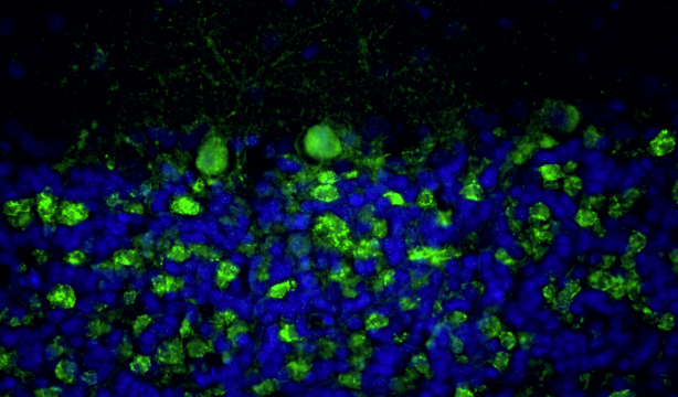 Representative section of formalin fixed, paraffin-embedded rat brain cerebellum region stained with anti-Bassoon recombinant chicken monoclonal antibody (green) (Cat No. 78-491) at 1:100 dilution. The sections were mounted with Antibodies Incorporated FluoroshieldTM with DAPI and DABCO mounting medium (Cat No. AR-6505). DAPI nuclear stain (blue) shows cell nuclei. Anti-Bassoon stains the presynaptic sites on Purkinje cell dendrites in the molecular layer of the cerebellum. ​​Magnification 400X.
