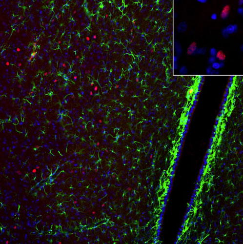 Representative image of 4% paraformaldehyde fixed free-floating rat brain sections stained with anti-c-FOS recombinant chicken monoclonal antibody (red) at 1:1000 dilution and co-stained with anti-GFAP rabbit polyclonal antibody (green). DAPI nuclear stain (blue) shows cell nuclei. Anti-c-FOS specifically stains only the nuclei of the spontaneously active neurons. Image courtesy of EnCor Biotechnology.
