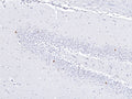 Representative image of formalin fixed paraffin embedded rat hippocampus section stained with anti-c-FOS recombinant chicken monoclonal antibody (brown) at 1:1000 dilution and counter-stained with hematoxylin (blue). Anti-c-FOS specifically stains only the nuclei of the spontaneously active neurons. Image courtesy of EnCor Biotechnology.