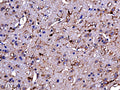 Representative image of 4% paraformaldehyde fixed free-floating mouse cortex sections stained with Aves Labs anti-TMEM119 recombinant chicken monoclonal antibody ( Cat No. 78-512) at 1:1000 dilution. Anti-TMEM119 specifically stains the microglial cells in the mouse cortex. Image courtesy of Gerry Shaw (EnCor