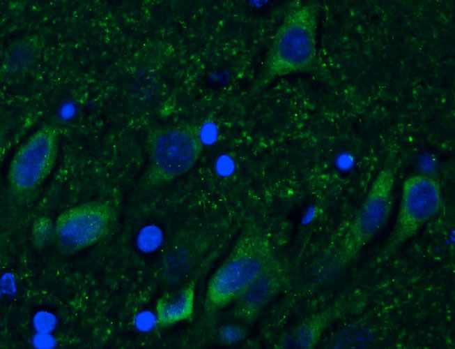 Immunohistochemistry for detection of CSPG4/NG2 in adult rat hippocampus using Aves Labs’ anti-CSPG4/NG2 recombinant chicken monoclonal antibody [6203-34] (Cat No. 78-523). Tissue was fixed with 4% paraformaldehyde and paraffin embedded. Heat induced antigen retrieval was performed using citrate buffer (Cat No. AR-6544) and then blocked with Immuno Protein Blocking Solution with Goat Serum (Cat No. AR-6591). The anti-CSPG4/NG2 antibody (Cat No. 78-523) was incubated with the sample at a dilution of 1:250 at 4C overnight. After washing with PBST, the sections were stained using goat anti-chicken IgY CF488 secondary antibody (Cat No. 80-1001-488) (green). DAPI nuclear stain (blue) shows cell nuclei.