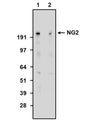 Western blot detection of CSPG4/NG2 using Aves Labs’ anti-CSPG4/NG2 recombinant chicken monoclonal antibody [6203-34] (Cat No. 78-523). 4-12% Bis-Tris Gel was loaded with rat whole brain homogenate. Proteins were transferred to PVDF membrane and blocked with 5% non-fat milk powder. Primary antibody was incubated with sample at a concentration of 10 ug/ml (lane 1) and 2 ug/ml (lane 2) and then detected via chemiluminescence (7 min) using a Goat Anti-Chicken H+L, HRP conjugated secondary antibody. Anti-CSPG4/NG2 antibody recognizes endogenous NG2 in the rat whole brain homogenate at the expected molecular weight of ~250 kDa.