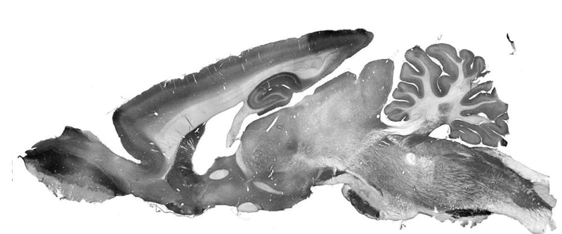 Immunohistochemistry staining of adult rat brain section using anti-Cav2.3 NeuroMab mouse monoclonal antibody (Clone N493/22). The variable region of this antibody was used to generate recombinant chicken chimeric anti-Cav2.3 antibody (78-531).