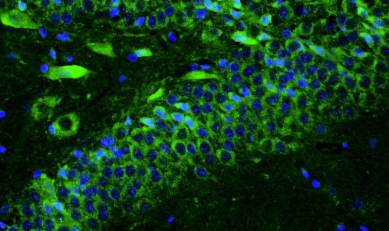 Immunohistochemistry for detection of TMEM240 in adult rat hippocampus using Aves Labs’ anti-TMEM240 recombinant chicken monoclonal antibody [N498/28] (Cat No. 78-533). Tissue was fixed with 4% paraformaldehyde and paraffin embedded. Heat induced antigen retrieval was performed using citrate buffer (Cat No. AR-6544) and then blocked with Immuno Protein Blocking Solution with Goat Serum (Cat No. AR-6591). The anti-TMEM240 antibody (Cat No. 78-533) was incubated with the sample at a dilution of 1:250 at 4C overnight. After washing with PBST, the sections were stained using goat anti-chicken IgY CF488 secondary antibody (Cat No. 80-1001-488) (green). DAPI nuclear stain (blue) shows cell nuclei.