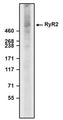 Western blot detection of Ryanodine Receptor (RyR2) using Aves Labs’ anti-RyR2 recombinant chicken monoclonal antibody [N501/49] (Cat No. 78-534). 3-8% Tris-Acetate Gel was loaded with rat brain membrane fraction. Proteins were transferred to PVDF membrane and blocked with 5% non-fat milk powder. Anti-RyR2 antibody was incubated with sample at a concentration of 2 ug/ml and then detected via chemiluminescence (3 min) using a Goat Anti-Chicken H+L, HRP conjugated secondary antibody. Anti-RyR2 recognizes endogenous RyR2 in the rat brain membrane fraction at the expected molecular weight of ~564 kDa.