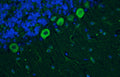 Immunohistochemistry for detection of Cav1.2 calcium channel in adult rat cerebellum using Aves Labs’ anti-Cav1.2 recombinant chicken monoclonal antibody [N500/4] (Cat No. 78-535). Tissue was fixed with 4% paraformaldehyde and paraffin embedded. Heat induced antigen retrieval was performed using citrate buffer (Cat No. AR-6544) and then blocked with Immuno Protein Blocking Solution with Goat Serum (Cat No. AR-6591). The anti-Cav1.2 antibody (Cat No. 78-535) was incubated with the sample at a dilution of 1:250 at 4C overnight. After washing with PBST, the sections were stained using goat anti-chicken IgY CF488 secondary antibody (Cat No. 80-1001-488) (green). DAPI nuclear stain (blue) shows cell nuclei.
