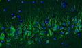 Immunohistochemistry for detection of Cav1.2 calcium channel in adult rat hippocampus using Aves Labs’ anti-Cav1.2 recombinant chicken monoclonal antibody [N500/4] (Cat No. 78-535). Tissue was fixed with 4% paraformaldehyde and paraffin embedded. Heat induced antigen retrieval was performed using citrate buffer (Cat No. AR-6544) and then blocked with Immuno Protein Blocking Solution with Goat Serum (Cat No. AR-6591). The anti-Cav1.2 antibody (Cat No. 78-535) was incubated with the sample at a dilution of 1:250 at 4C overnight. After washing with PBST, the sections were stained using goat anti-chicken IgY CF488 secondary antibody (Cat No. 80-1001-488) (green). DAPI nuclear stain (blue) shows cell nuclei.