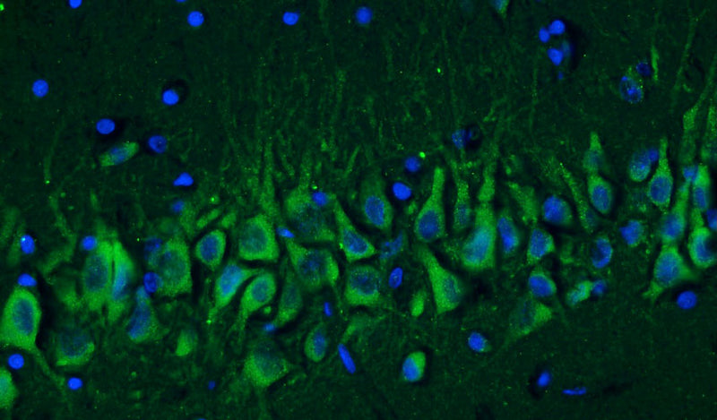 Immunohistochemistry for detection of Cav1.2 calcium channel in adult rat hippocampus using Aves Labs’ anti-Cav1.2 recombinant chicken monoclonal antibody [N500/4] (Cat No. 78-535). Tissue was fixed with 4% paraformaldehyde and paraffin embedded. Heat induced antigen retrieval was performed using citrate buffer (Cat No. AR-6544) and then blocked with Immuno Protein Blocking Solution with Goat Serum (Cat No. AR-6591). The anti-Cav1.2 antibody (Cat No. 78-535) was incubated with the sample at a dilution of 1:250 at 4C overnight. After washing with PBST, the sections were stained using goat anti-chicken IgY CF488 secondary antibody (Cat No. 80-1001-488) (green). DAPI nuclear stain (blue) shows cell nuclei.