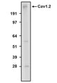 Western blot detection of Cav1.2 Ca2+ channel using Aves Labs’ anti-Cav1.2 recombinant chicken monoclonal antibody [N500/4] (Cat No. 78-535). 4-12% Bis-Tris Gel was loaded with rat brain membrane fraction. Proteins were transferred to PVDF membrane and blocked with 5% non-fat milk powder. Anti-Cav1.2 antibody was incubated with sample at a concentration of 2 ug/ml and then detected via chemiluminescence (6 min) using a Goat Anti-Chicken H+L, HRP conjugated secondary antibody. Anti-Cav1.2 recognizes endogenous Cav1.2 calcium channel in the rat brain membrane fraction at the expected molecular weight of ~240 kDa.
