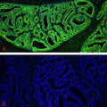 Immunofluorescent staining for detection of cytoskeleton in human colon cancer tissue using Aves Labs anti-Cytokeratin 8 (CK8) chicken recombinant monoclonal antibody (Cat No. 78-602) at 1:1000 dilution (Image A). Image B depicts the absence of staining in a secondary only control. The sections of formalin fixed, paraffin embedded colon cancer tissue were blocked with Immuno Protein Blocking Solution with 5% Goat Serum (AR-6591-04). After washing with TBST, the tissues were stained using goat anti-chicken IgY FITC conjugated secondary antibody (Cat No. 80-1000-FITC) (green). The tissues were mounted with Antibodies Incorporated Fluoroshield with DAPI and DABCO mounting medium (Cat No. AR-6505). DAPI nuclear stain (blue) shows cell nuclei. Magnification 100X.