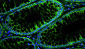 Immunofluorescent staining for detection of cytoskeleton in human colon cancer tissue using Aves Labs anti-E-Cadherin chicken recombinant monoclonal antibody (Cat No. 78-608) at 1:1000 dilution. This section of formalin fixed, paraffin embedded colon cancer tissue was blocked with Immuno Protein Blocking Solution with 5% Goat Serum (AR-6591-04). After washing with TBST, the tissue was stained using goat anti-chicken IgY FITC conjugated secondary antibody (Cat No. 80-1000-FITC) (green). The tissue was mounted with Antibodies Incorporated Fluoroshield with DAPI and DABCO mounting medium (Cat No. AR-6505). DAPI nuclear stain (blue) shows cell nuclei. Magnification 400X.