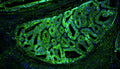 Immunofluorescent staining for detection of cytoskeleton in human colon cancer tissue using Aves Labs anti-E-Cadherin chicken recombinant monoclonal antibody (Cat No. 78-608) at 1:500 dilution. This section of formalin fixed, paraffin embedded colon cancer tissue was blocked with Immuno Protein Blocking Solution with 5% Goat Serum (AR-6591-04). After washing with TBST, the tissue was stained using goat anti-chicken IgY FITC conjugated secondary antibody (Cat No. 80-1000-FITC) (green). The tissue was mounted with Antibodies Incorporated Fluoroshield with DAPI and DABCO mounting medium (Cat No. AR-6505). DAPI nuclear stain (blue) shows cell nuclei. Magnification 100X.