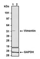 Western blot detection of Vimentin in SH-SY5Y (lane 1) and MCF-7 (lane 2) cell lysates using Aves Labs anti-Vimentin chicken recombinant antibody [LN6](Cat No. 78-610). 4-12% Bis-Tris gel was loaded with 20 ug of SH-SY5Y and MCF-7 cell lysates. Proteins were transferred to PVDF membrane and blocked with 5% non-fat milk powder. Anti-Vimentin chicken antibody was incubated with the membrane at a concentration of 1:1000 (1 ug/ml) and then detected via chemiluminescence (20 min) using a goat anti-Chicken H+L, HRP conjugated secondary antibody. Anti-Vimentin chicken recombinant antibody specifically recognizes endogenous vimentin only in SH-SY5Y cell lysates but not in vimentin negative MCF-7 cell lysates at the expected molecular weight of ~50 kDa. GAPDH was used as a loading control.