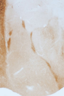 Immunostaining of rat amygdala showing labeling of GABAA α3 subunit (DAB, 1:100).