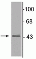 Western blot of 10 µg of rat hippocampal lysate showing specific immunolabeling of the ~46 kDa γ2-subunit of the GABAA-R. 
