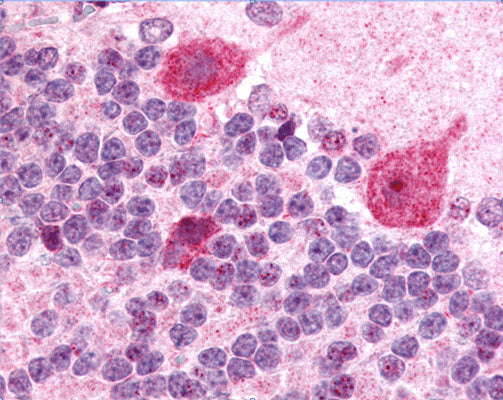 Immunostaining of rat cerebellum showing labeling of GABAA γ2 subunit in fuchsia.