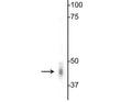 Western blot of mouse whole brain lysate showing specific immunolabeling of the ~46 kDa γ2-subunit of GABAA Receptor.