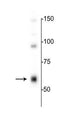 Western blot of rat hippocampal lysate showing specific immunolabeling of the ~64 kDa α4-subunit of the GABAA-R. 