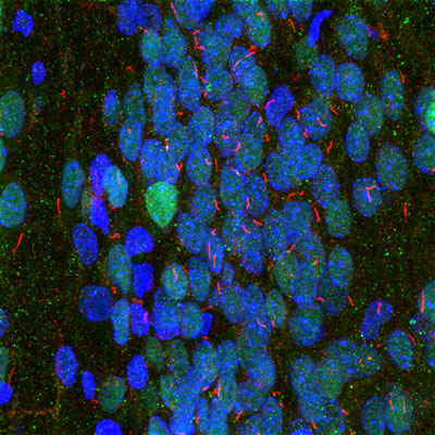 Immunofluorescence of a section of rat hippocampus selectively labeling the neuronal cilia with anti-adenylate cyclase III (cat. 85-AC3, 1:10,000, red), labeling nuclei with anti-MECP2 (cat. 1205-MeCP2, 1:1000,green), and Hoechst staining of nuclear DNA.
