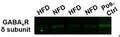 Western blot image of mouse whole brain showing no change in protein levels of GABA A (δ) receptor (Cat. 868A-GDN, 1:500) when mice are given normal fat diet (NFD) or high fat diet (HFD) for 15 days. Image from publication
