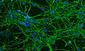 Immunofluorescence of rat neuron/glial culture labeling GAP43 protein (Cat. 875-GAP43, 1:2000, green) expressed in the axonal membrane and synapses of neuronal cells. DAPI (blue) was used for nuclear staining.