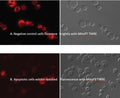 Figure 1. Jurkat cells were treated with DMSO (negative control) or 1 µM staurosporine to induce apoptosis, then stained with TMRE, and photographed using a photomicroscope using a green excitation filter at 510-560 nm and a 570-620 nm emission filter (left). Healthy cells, containing mitochondria with polarized inner membranes fluoresce bright orange (A) compared with apoptotic cells with depolarized mitochondria(B). The corresponding DIC images are shown (right) (Dr. Brian Lee, ICT).