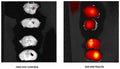 Figure 1. Brain abscesses were induced in mice following inoculation of live S. aureus. Mice received i.v. injections of DyLight® 690-VAD-FMK tracer or DyLight® 690 Dye Control (Cat. 9113) 17 hours post-infection; brain tissue was imaged 1 hour later ex vivo using an IVIS® Spectrum™ (Caliper Life Sciences). Strong