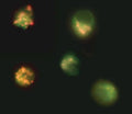 Figure 1. Jurkat cells were treated with DMSO (negative control) or 1 µM staurosporine for 2 hours to induce apoptosis. Cells were then stained with JC-1 dye. Normal healthy cells (two cells, upper and lower left) concentrate JC-1 in mitochondria and fluoresce bright orange. Apoptotic cells (three cells, right), with mitochondria of various stages of permeability, exhibit a reduced orange fluorescence and increased green fluorescence, as JC-1 disperses through the cells. (Dr. Brian Lee, ICT).
