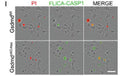 Gasdermin D mediated pyroptosis in vivo and in vitro and correlated with the accumulation of DNA damage. NPCs were isolated from Gsdmd fl/flmice and GsdmdcKO-Nes mice and cultured in vitro for 24 h, and cells were stained with FLICA-CASP1 (Cat. 9122) for 1 h and Propidium iodide. The images were visualized using microscopy. Scale bar, 50 µm. Image from publication, CC-BY-4.0,