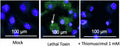 BMDM were treated with lethal toxin for three hours in the presence of thiomuscimol. Caspase-1 activation was detected using FAM-YVAD-FMK (Cat. 9122, green) and nuclei were counterstained (blue). Image from publication. PMID: 39550359.